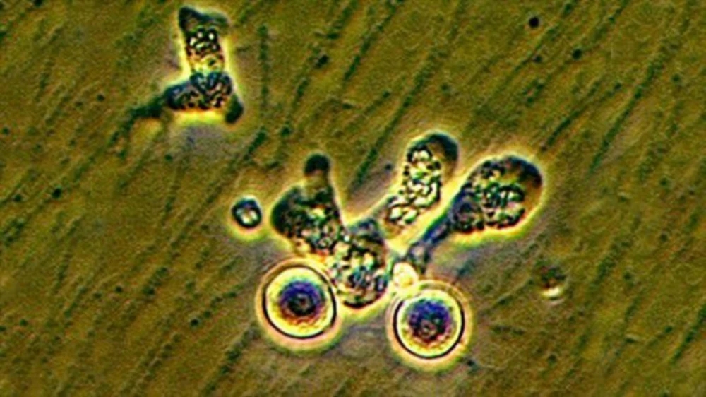 韩国首例“食脑阿米巴”感染病例,患者出现症状10多天后死亡